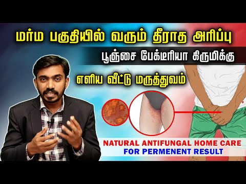 அந்த பகுதியில் அரிப்பு தடிப்பு 3 பொருட்கள் வீட்டிலேயே சரி செய்யலாம்  Itching Rashes Home cure |