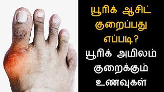 யூரிக் ஆசிட் குறைப்பது எப்படி.? யூரிக் அமிலம் குறைக்கும் உணவுகள் | How to Cure Uric Acid Problems