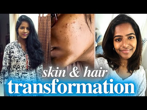 Hair & Skin Transformation from the last 15 years😭MAJOR REGRETS..story time