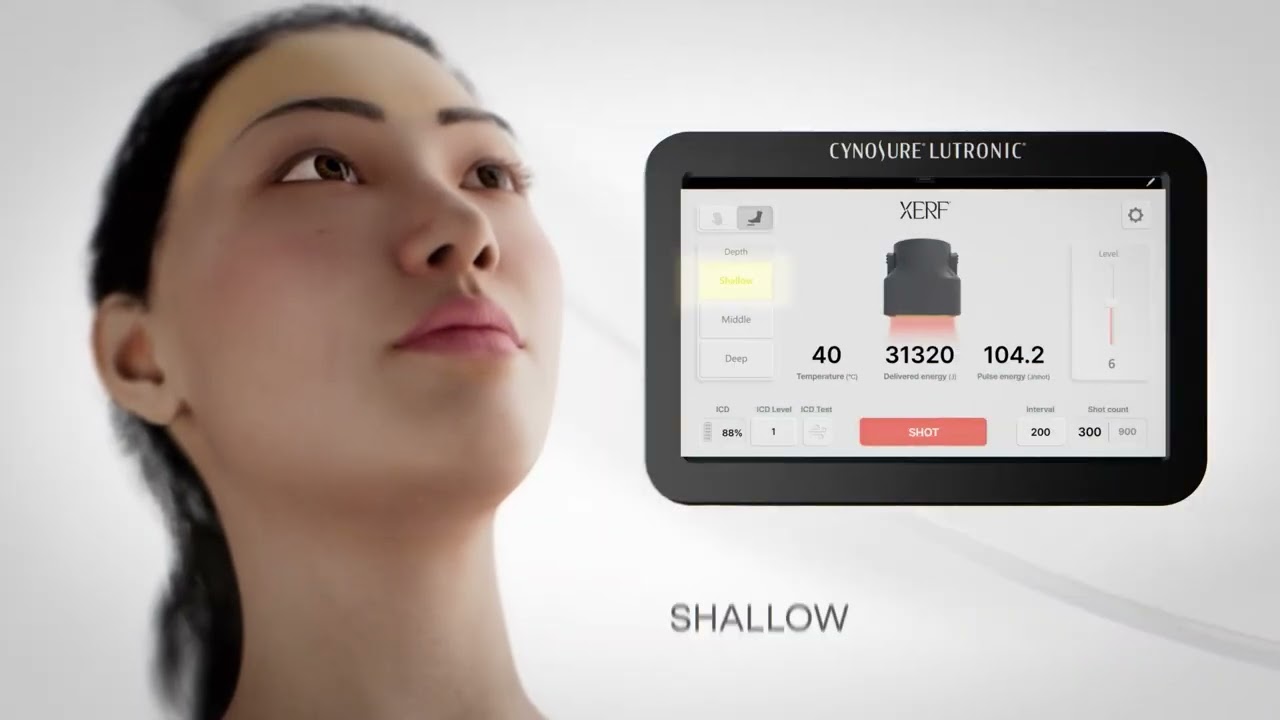 Skin treatment device settings for shallow depth.