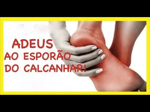 Exercícios Esporão de Calcâneo Dor no Calcanhar TRATAMENTO Clínica de Fisioterapia Dr. Robson Sitta