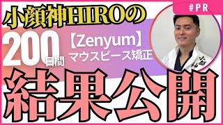 マウスピース矯正【Zenyum】200日終了！結果報告と感想をお伝えします！！#PR #zenyum