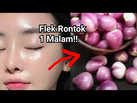 VIRAL!! CARA ORANG KAYA MENGHILANGKAN FLEK HITAM PAKAI BUMBU DAPUR!!