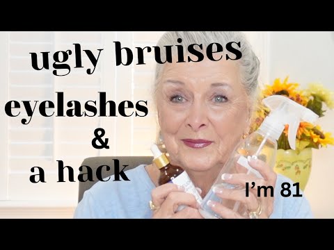 Ugly Bruises|Eyelashes & Hack~Get Ready With me !👀