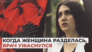 ЕЕ ГРУДЬ УВЕЛИЧИЛАСЬ ДО ОГРОМНЫХ РАЗМЕРОВ И ПОКРЫЛАСЬ ЯЗВАМИ! ОТКРОВЕНИЯ ОНКОЛОГА