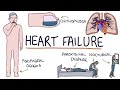 Heart Failure Symptoms and Management