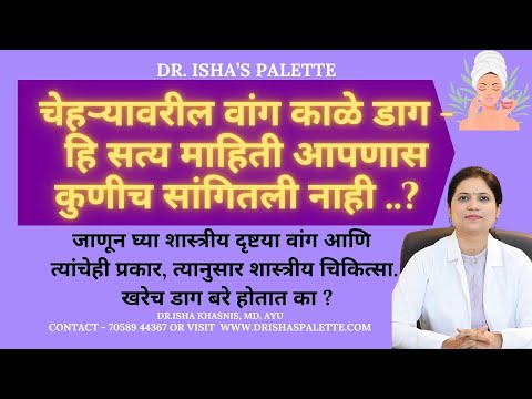 चेहऱ्यावरील वांग काळे डाग - हि सत्य माहिती आपणास कुणीच सांगितली नाही ..? डाग बरे होतात का ?