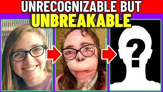 They Tore Off Her Face. She Lived... Plastic Surgeon Reveals.