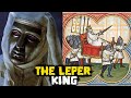 Exploring the Life of Baldwin IV: The Leper King of Jerusalem