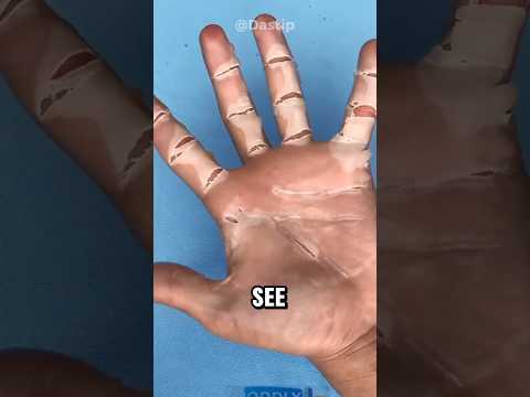 Skin peeling 😲‼️