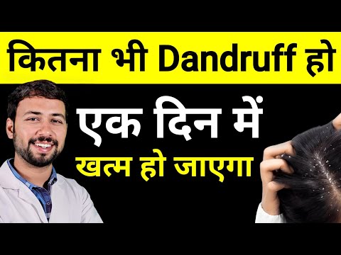 Dandruff ka permanent Solution at Home | Dandruff ka ilaj | dandruff treatment at home