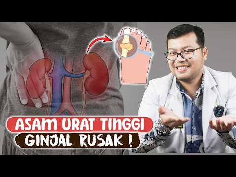 ASAM URAT TINGGI AWAS BISA JADI GINJAL BERMASALAH - DOKTER SADDAM ISMAIL