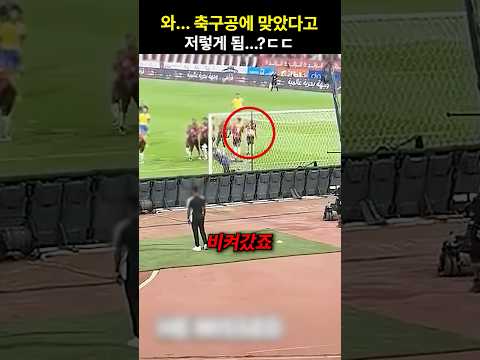와… 축구공에 맞았다고 저렇게 됨…?ㄷㄷ