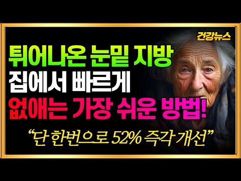 눈밑지방! 집에서 빠르게 없애는 가장 쉬운 방법! 이런 기적은 처음 봅니다!