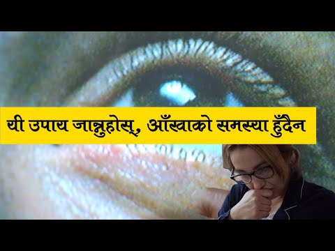 यी उपाय जान्नुहोस्, आँखाको समस्या हुँदैन | Eye Health Tips