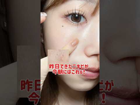 個人的には結構好き💚生理前のニキビ肌荒れ季節の変わり目の肌荒れのお守りケアに💚 #垢抜け #美容 #スキンケア
