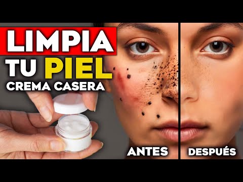 PIEL PERFECTA en 5 MINUTOS!! La MASCARILLA CASERA de YOGUR Elimina MANCHAS, ARRUGAS y LIMPIA POROS