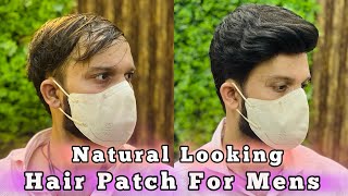 Permanent Hair Patch Delhi | Hair Wigs For Mens | Call : 9650914665