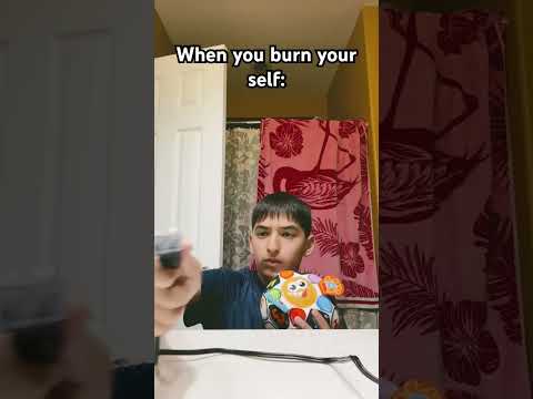 When you burn your self… 🔥🔥 #funny #comedy 🤣🤣🤣