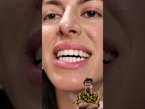 ردود فعل بوتش على الحركة المذهلة!