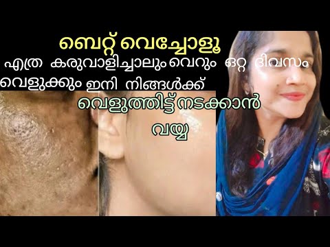 😱മുഖംതിളങ്ങൻ ചെയ്യാവുന്ന ഒരു അടിപൊളി face pack| Skin lightening face pack #skincare #tips