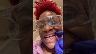 GETTING BRACES - Part 8 {+ AN EMERGENCY APPT}