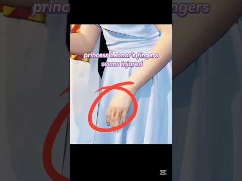 princess Leonor fingers were injured