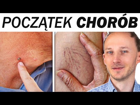 Masz to na skórze? Twój organizm woła o pomoc (i co musisz zrobić)