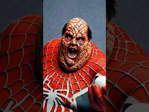 My eggs🥚🕷️🤢