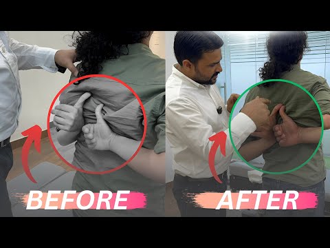 Shoulder blade pain treatment by dr harish grover