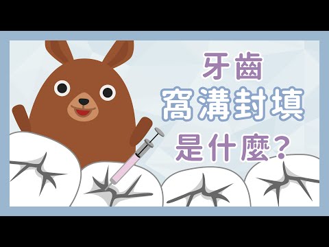 什麼是窩溝封填–更新版 - YouTube