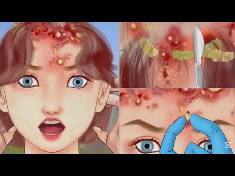 animation 《ASMR》 Treatment of hair loss and removal of blackheads