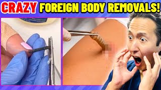 Doctor Reacts to EXTREME & SATISFYING Foreign Body Removals 2!