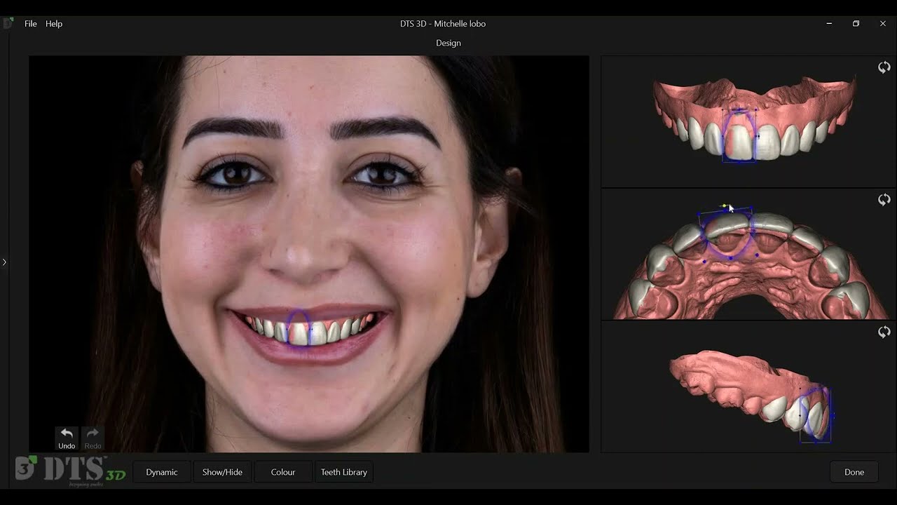 DTS 3D