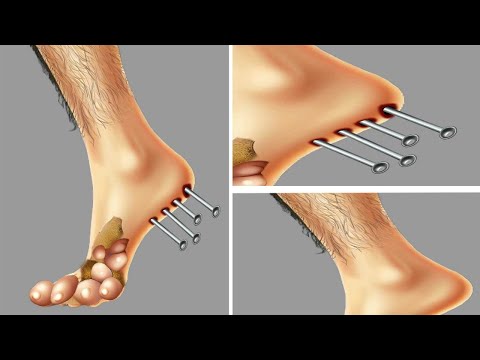 ASMR  Foot Care Treatment