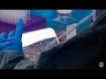 Regenerative Medicine and Stem Cells