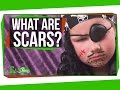 Understanding Scars and Their Treatments