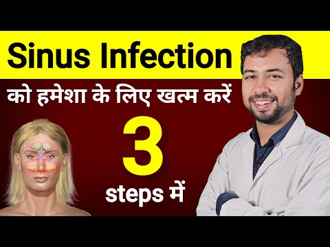 साइनस का 2-दिन में जड़ से इलाज | sinus treatment home tips | sinus ka gharelu upchar | sinus ka ilaj