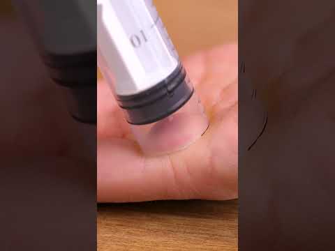 Stuck splinter gets removed easily