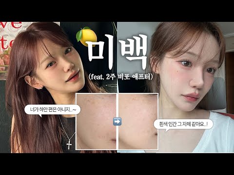 모태 환한피부❌ 관리빨⭕️ 미백무새가 정리해주는 피부 속부터 맑아지는 법!🍋 이것만 따라하세요💁🏻‍♀️ 습관부터 미백 추천템까지!