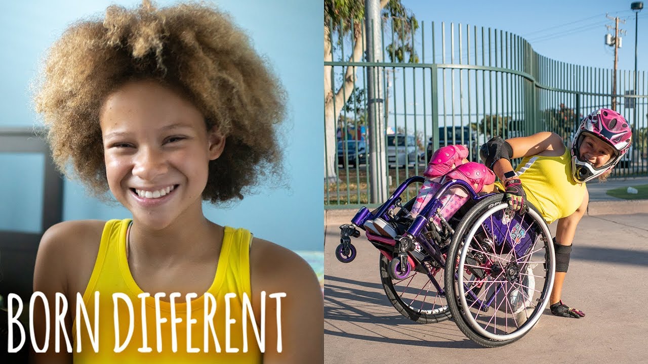 Spina bifida won-t hold this 12-year-old back - born different