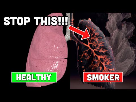 Doctor Explains: How to PURIFY Smokers Lungs!