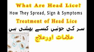 How Head Lice Spread ? Signs & Symptoms and Treatment  / سر کی جوئیں کیسے پھیلتی ہیں ,علامات اورعلاج