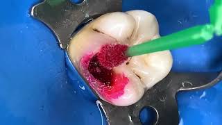 Dental treatment that you think is a minor problem