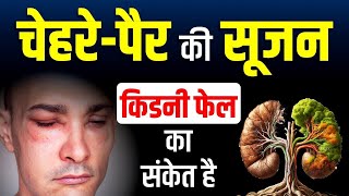 Kidney Kharab Hone Ke Lakshan | 🧑‍⚕️चेहरे-पैर में सूजन?🚨किडनी का इशारा | Kidney Treatment | #kidney