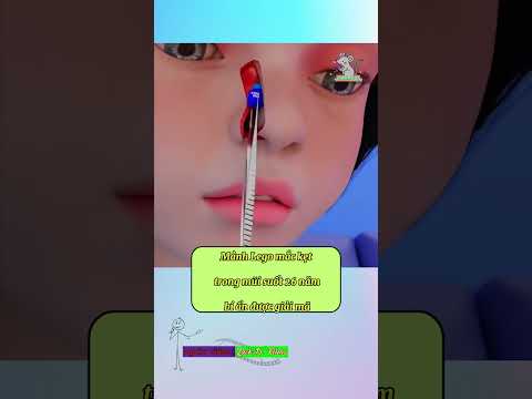 Mảnh lego bị mắc kẹt