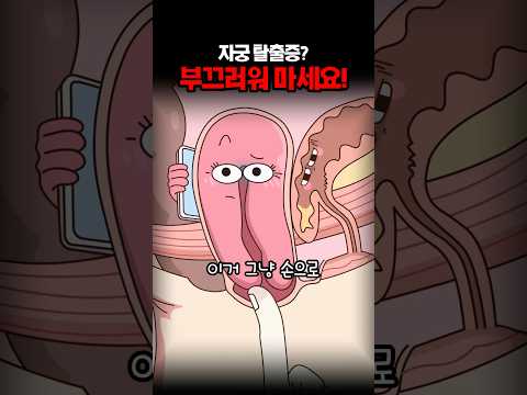 자궁탈출증? 부끄러워 마세요!