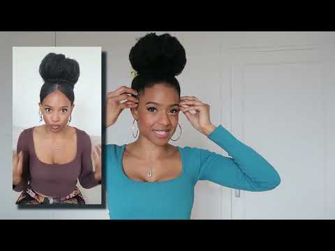 Ma GREFFE CAPILLAIRE! (cheveux afro) Opération pour mes tempes dégarnies