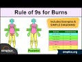 Understanding the Rule of Nines