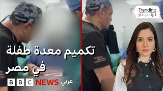 عملية تكميم معدة طفلة في مصر تثير جدلا.. هل هذه الجراحات ملائمة للأطفال؟